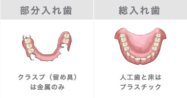 部分入れ歯・総入れ歯