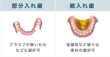 部分入れ歯・総入れ歯