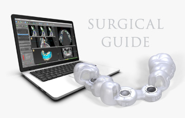 SURGICAL GUIDE