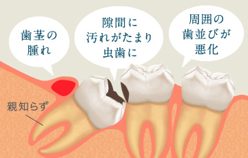 歯茎の腫れ・隙間に汚れがたまり虫歯に・周囲の歯並びが悪化